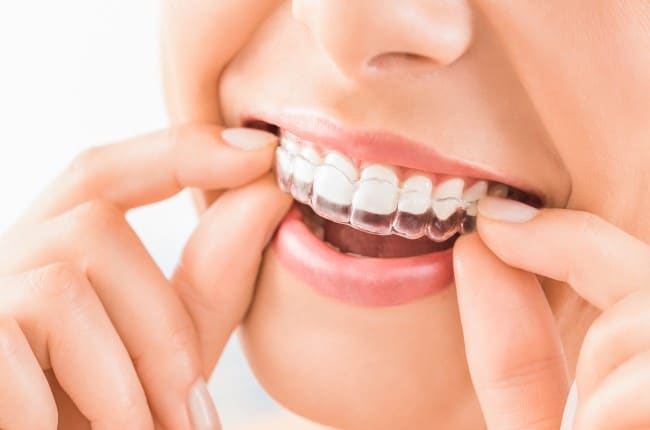 Apiñamiento dental, ¿Cómo corregirlo?