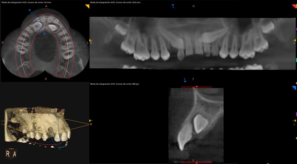 Escaner Dental Radiodiagnóstico 3D Panorámica Clínica Dental en Pinto Dres. de Benito