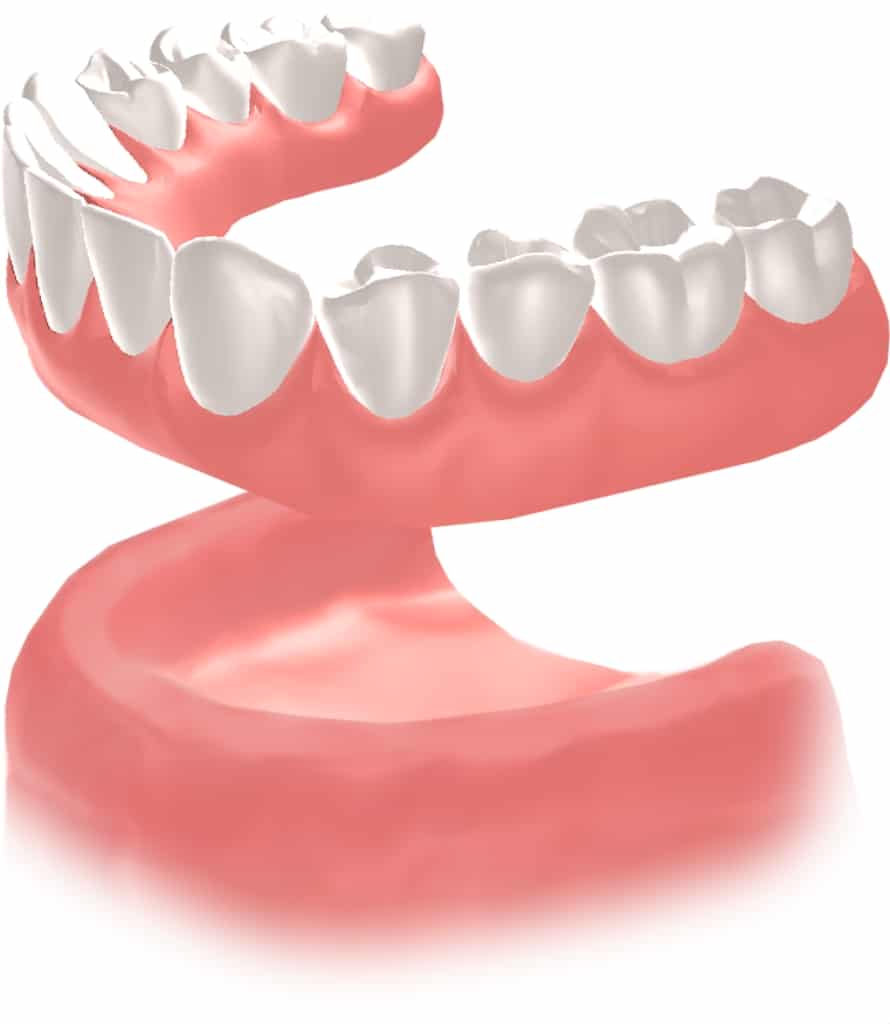 implante Straumann Clínica Dental en Pinto Dres. de Benito