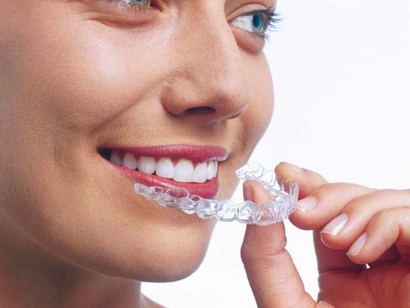 ortodoncia invisible invisalign clinica dental en pinto