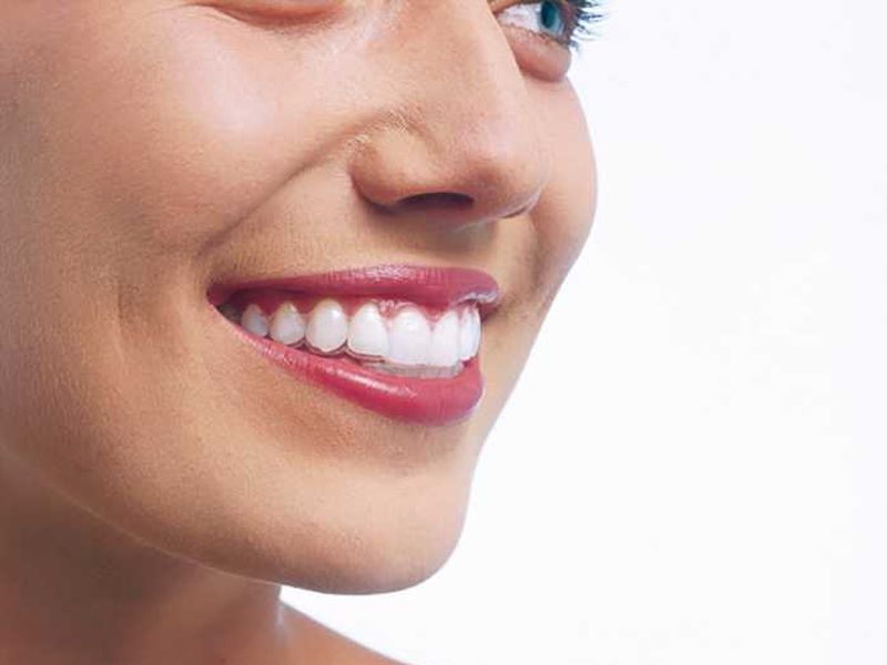 ortodoncia invisible invisalign clinica dental en pinto